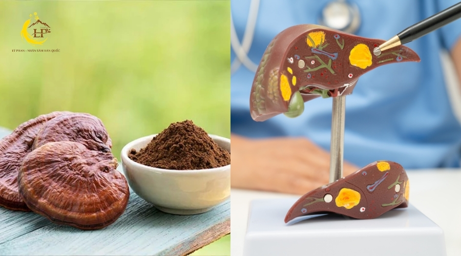 Gây áp lực lên gan Gây áp lực lên gan