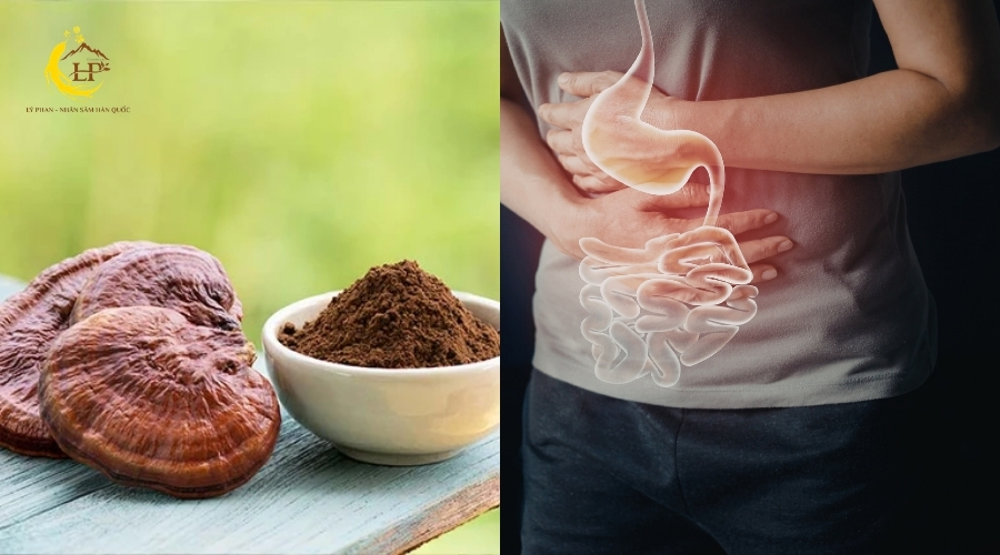 Rối loạn tiêu hóa Rối loạn tiêu hóa